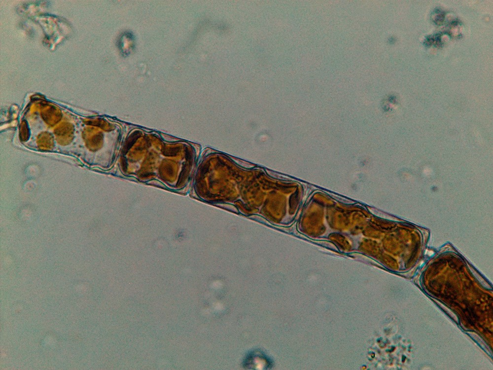 Melosira (prova)